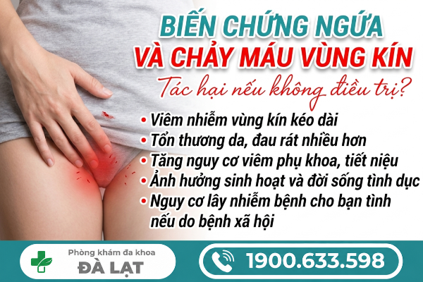 Hình ảnh minh họa